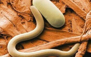 Виды паразитов, которым подвержен человек